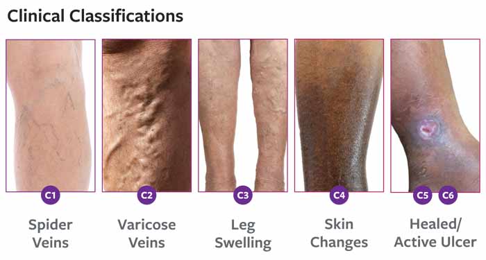 clinical-classifications