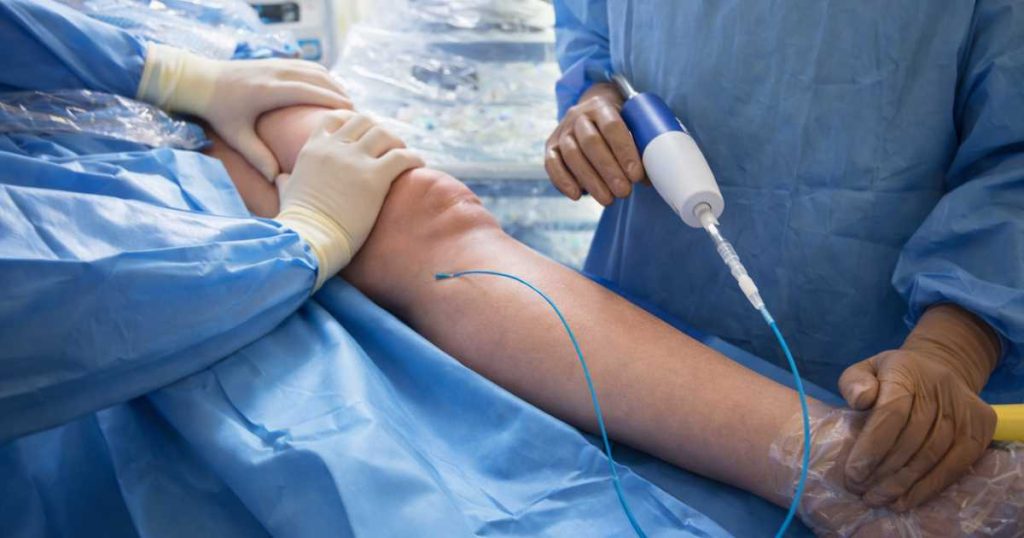 Modern Varicose Veins Treatment Designed for Active Lifestyles