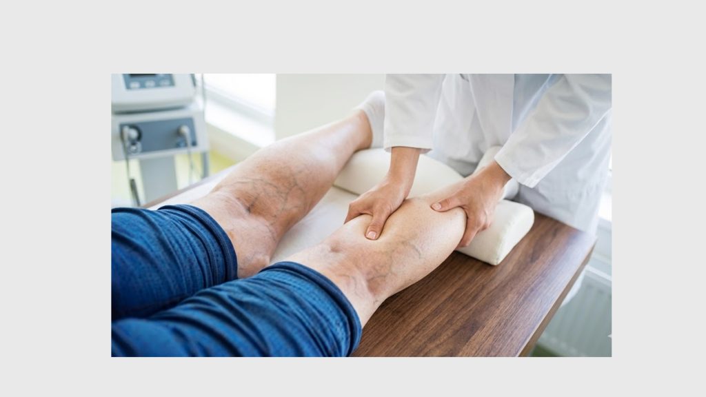 Choosing the Right Specialist for Venous Reflux Disease Treatment