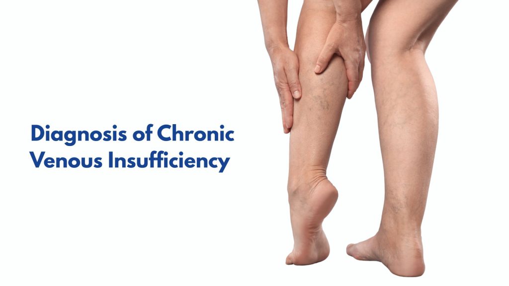 Diagnosis of Chronic Venous Insufficiency: What to Expect