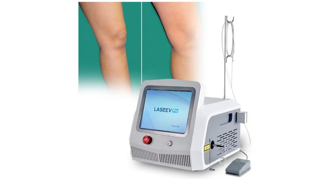 Is Endovenous Laser Ablation Treatment Safe?