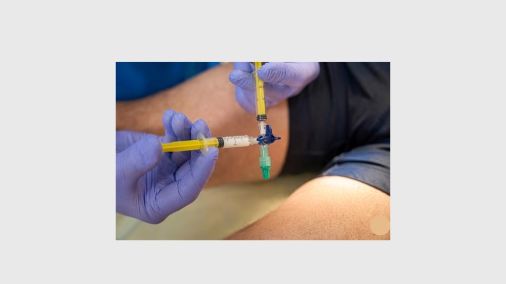 Sclerotherapy vs Laser Ablation Comparison