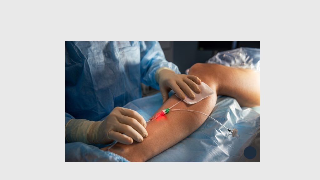 What Is Laser Ablation Surgery for Venous Reflux Disease?