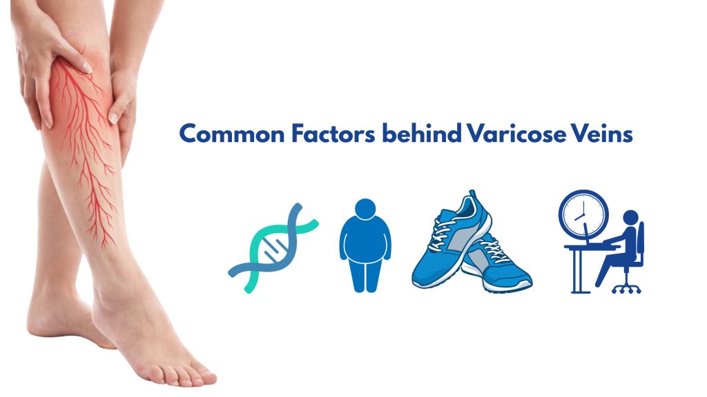Common Factors behind Varicose Veins​